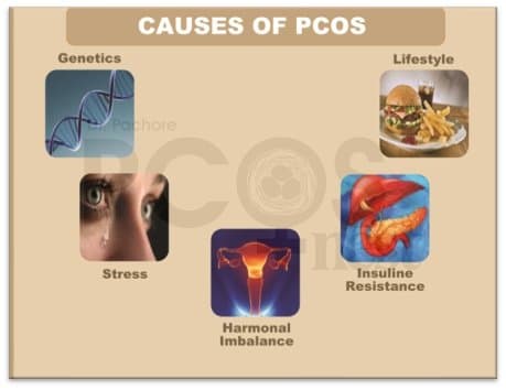 PCOS Causes